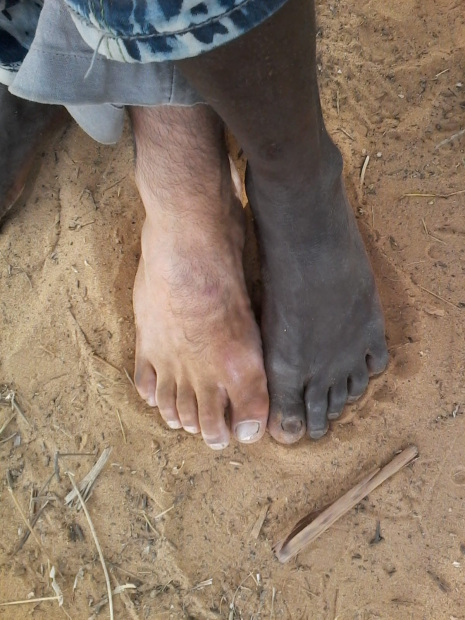 Humanitarian action